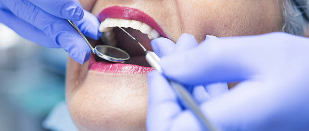 Best Emergency Dental Care for Abscessed Tooth in Millville, UT